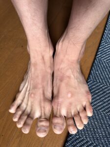 ハイボルトを卒業した日—動けない時間で、人生の脚本を書き直している