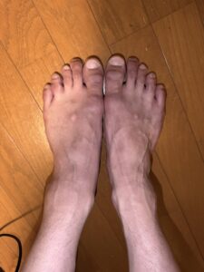 ハイボルトを卒業した日—動けない時間で、人生の脚本を書き直している
